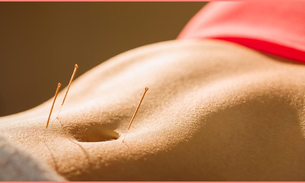 Exercice de l’acupuncture