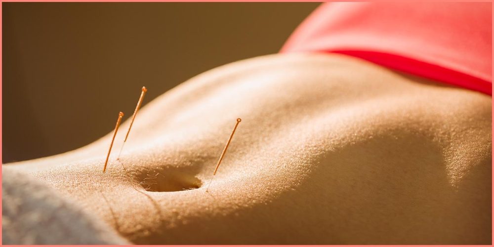 Exercice de l’acupuncture